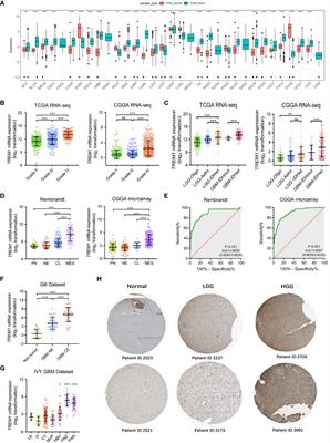 Molecular and immunological features of TREM1 and its emergence as a prognostic indicator in glioma